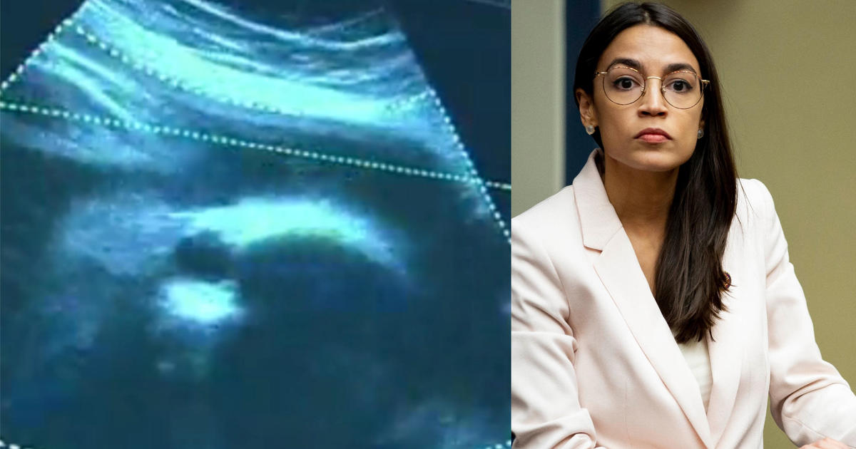 AOC fetal heartbeat bill:  Alexandria Ocasio-Cortez says on Twitter abortion bans are a "brutal form of oppression" and are "about controlling women