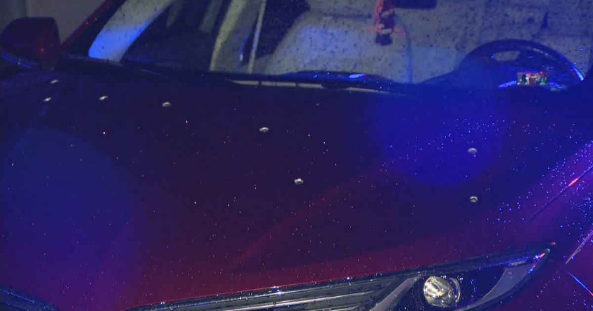 20-Year-Old Man Fighting For Life After Being Shot 11 Times, Police Say ...
