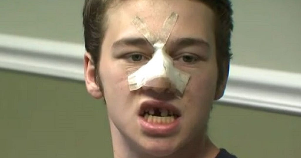 Center Moriches HS Student, Parents File 10M Lawsuit Against District