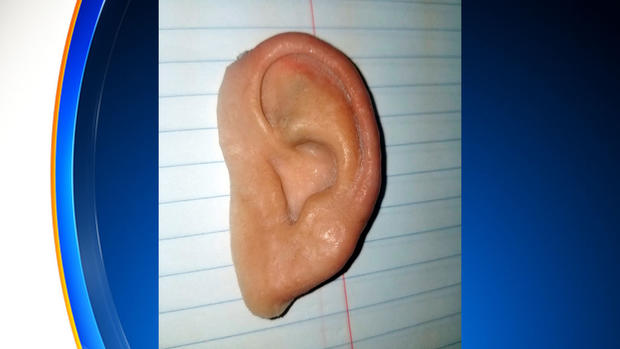 Prosthetic Ear Found On Florida Beach 