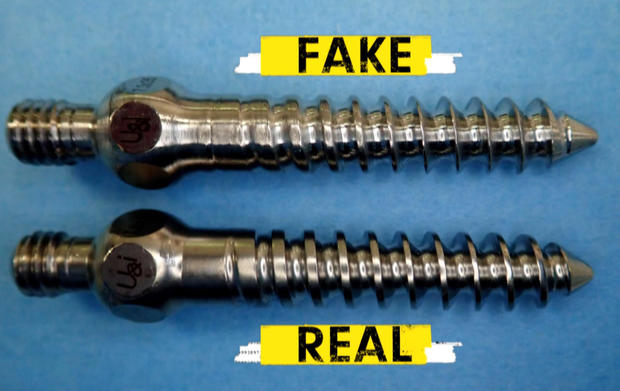 real vs. counterfeit spinal surgery screws 