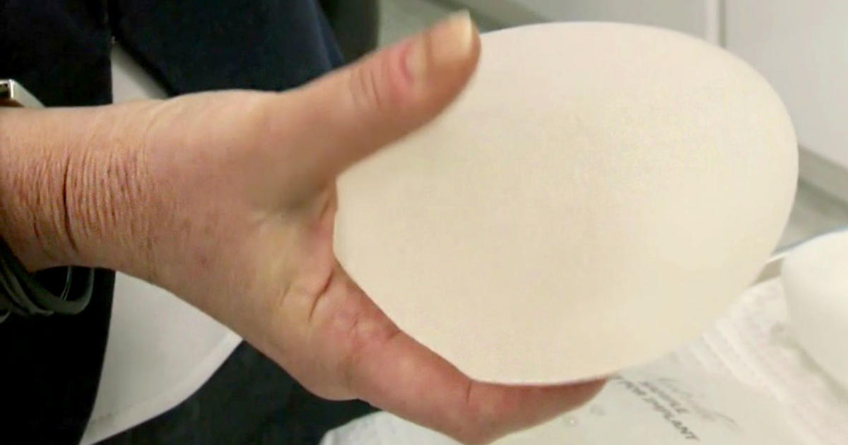 Recall Alert Textured Breast Implant Tied To Rare Cancer Taken Off Us Market Cbs New York 
