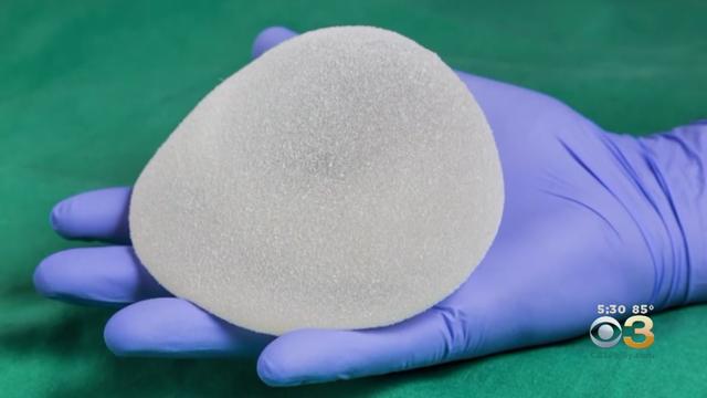 breast-implant.jpg 