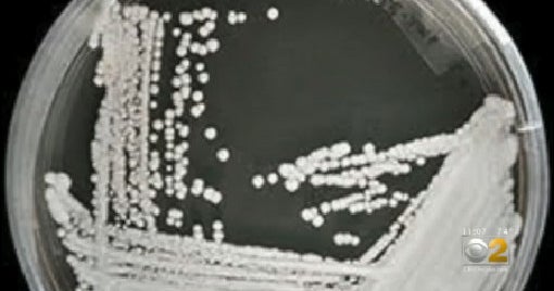 CDC Detects More Than 700 Cases Of Deadly Fungus; One Of Largest