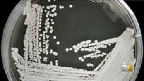 Candida-auris.jpg 