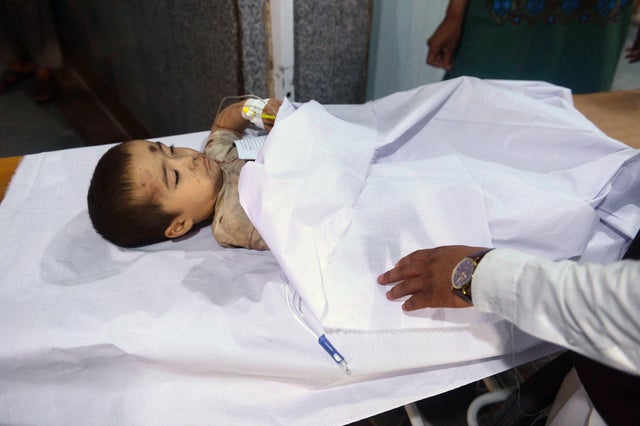 AFGHANISTAN-CONFLICT-CASUALTIES-BUS 