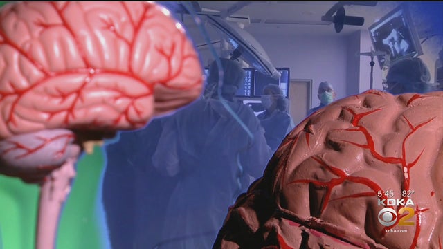 aneurysmdrmaria.jpg 