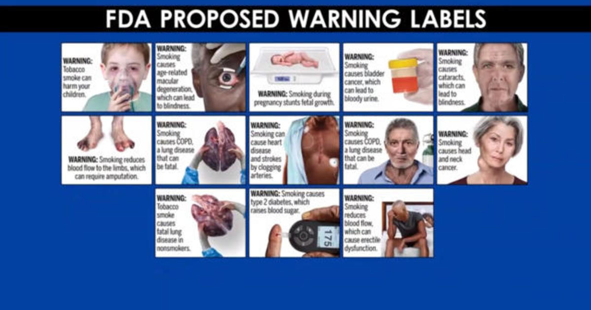 FDA proposing graphic warning labels for cigarettes