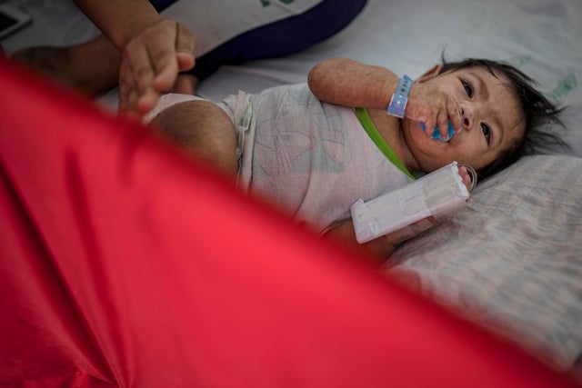 Measles Outbreak In The Philippines 