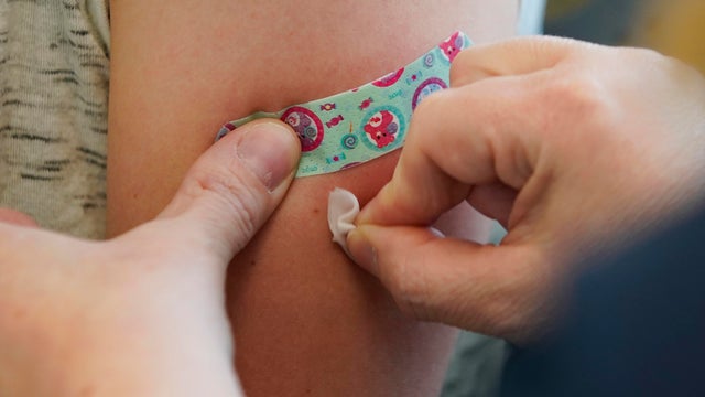 Measles Makes Comeback, As Outbreak Happens In 22 States 