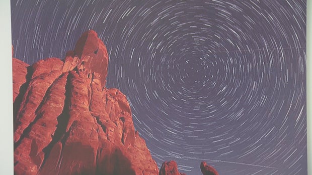 CORNEA TRANSPLANT PHOTOS 5PKG_frame_2106 