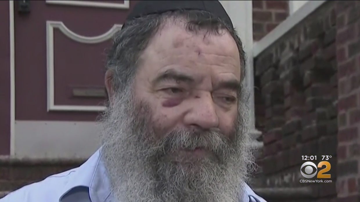Suspect Accused Of Beating Jewish Man With Large Stone In Custody - CBS ...