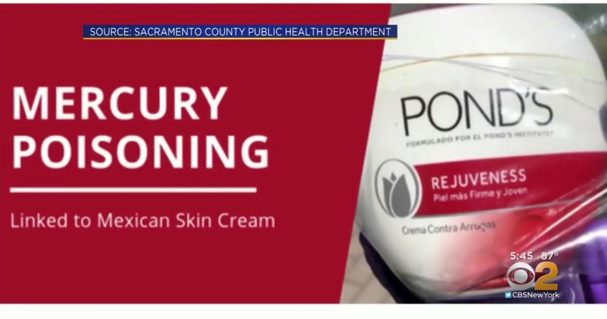 Mercury Poisoning Linked To Skin Creams Imported From Mexico, Health