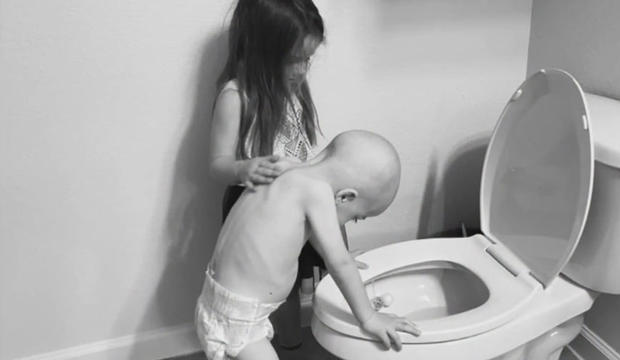 pediatric cancer photo 