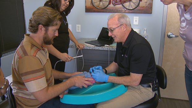 TONGUE TIE 6PKG.transfer_frame_698 