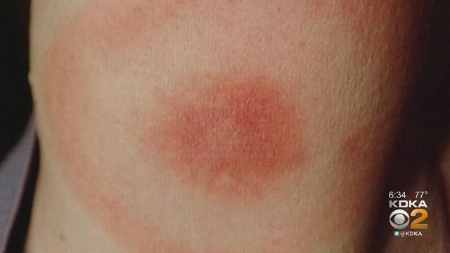 ticks.jpg 