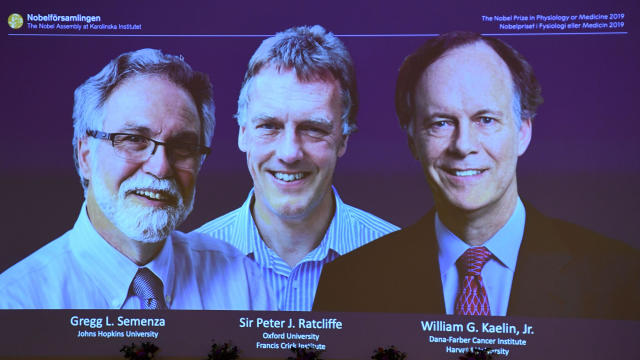 From left to right, the winners of the 2019 Nobel Prize in physiology or medicine, Gregg Semenza of the U.S., Peter Ratcliffe of Britain and William Kaelin of the U.S., appear on a screen during a press conference at the Karolinska Institute in Stockholm, Sweden, on October 7, 2019. 