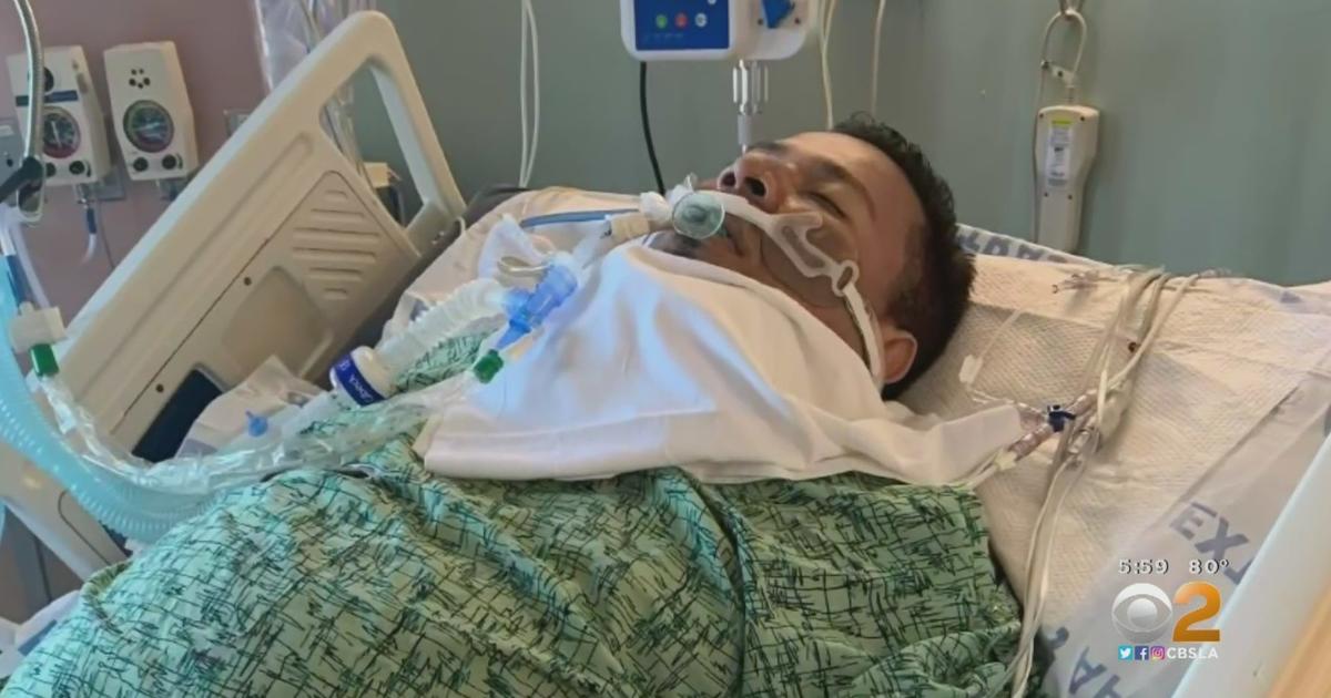 Fox 11 Los Angeles - A man is in a medically-induced coma after