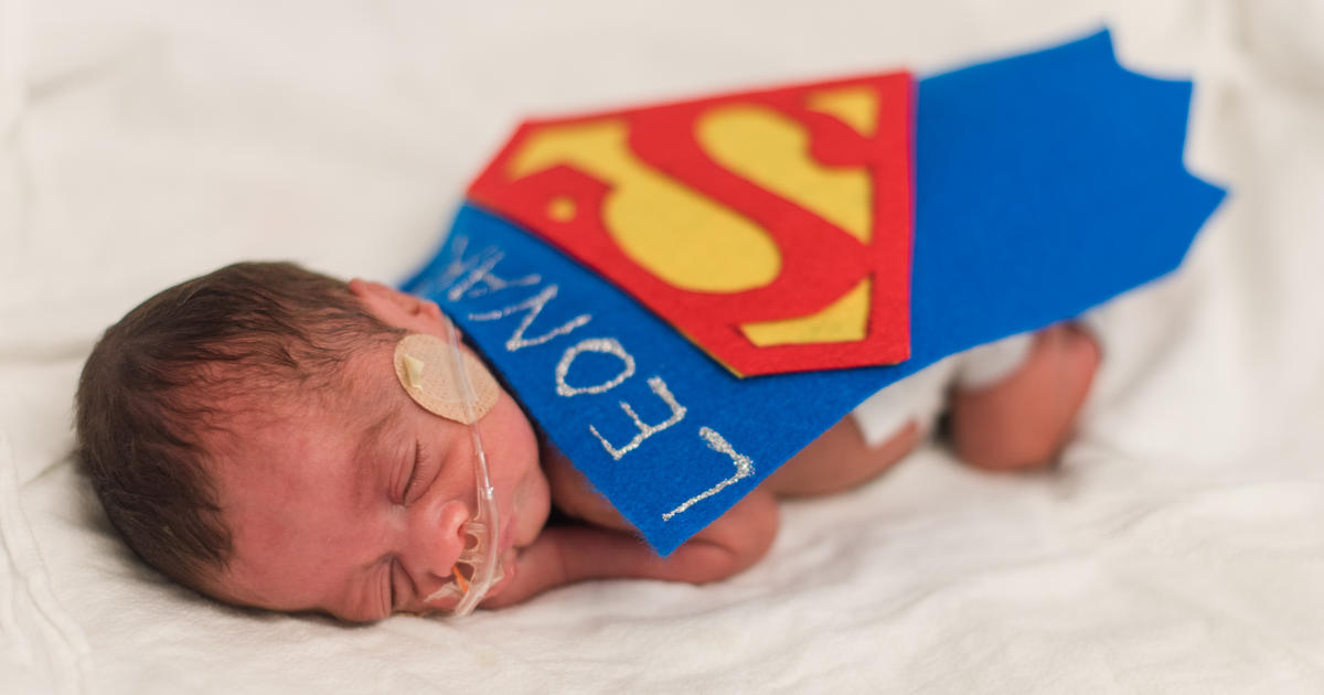 Enjoy these photos of tiny babies at Methodist Dallas and other kids in  costume for Halloween