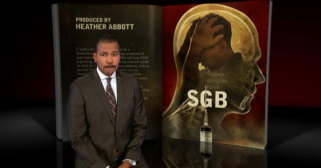 SGB: A possible breakthrough treatment for PTSD