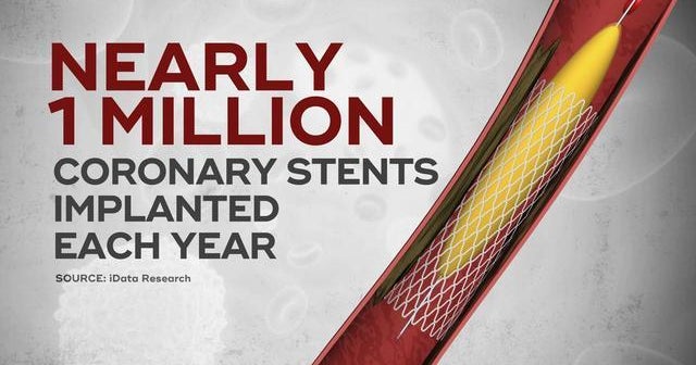 Heart disease trial could reduce the number of patients getting stents