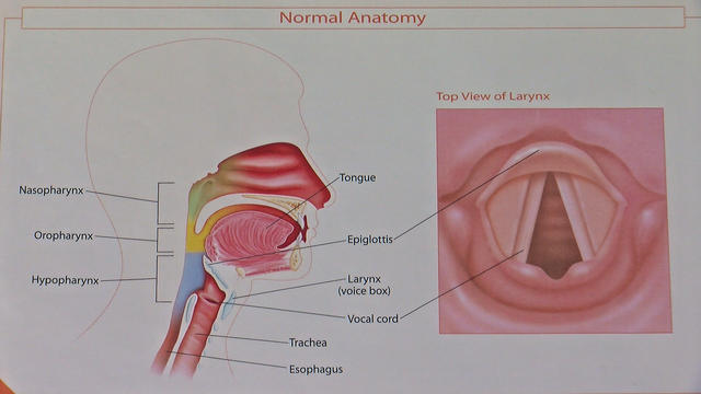 Larynx.jpg 