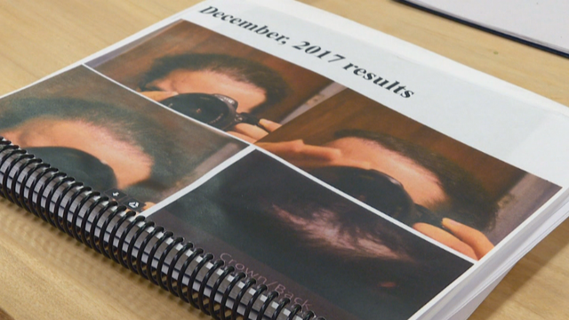 Hair-Transplant-PKG_frame_3511.png 