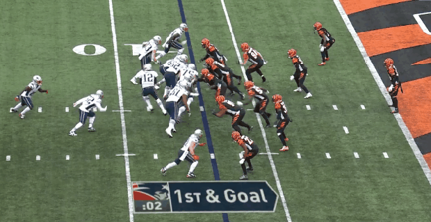 Tom Brady miss 
