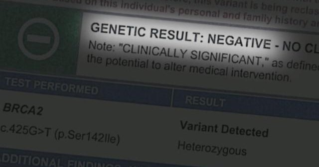 BRCA gene test questioned after unnecessary surgeries BRCA gene test questioned after unnecessary surgeries