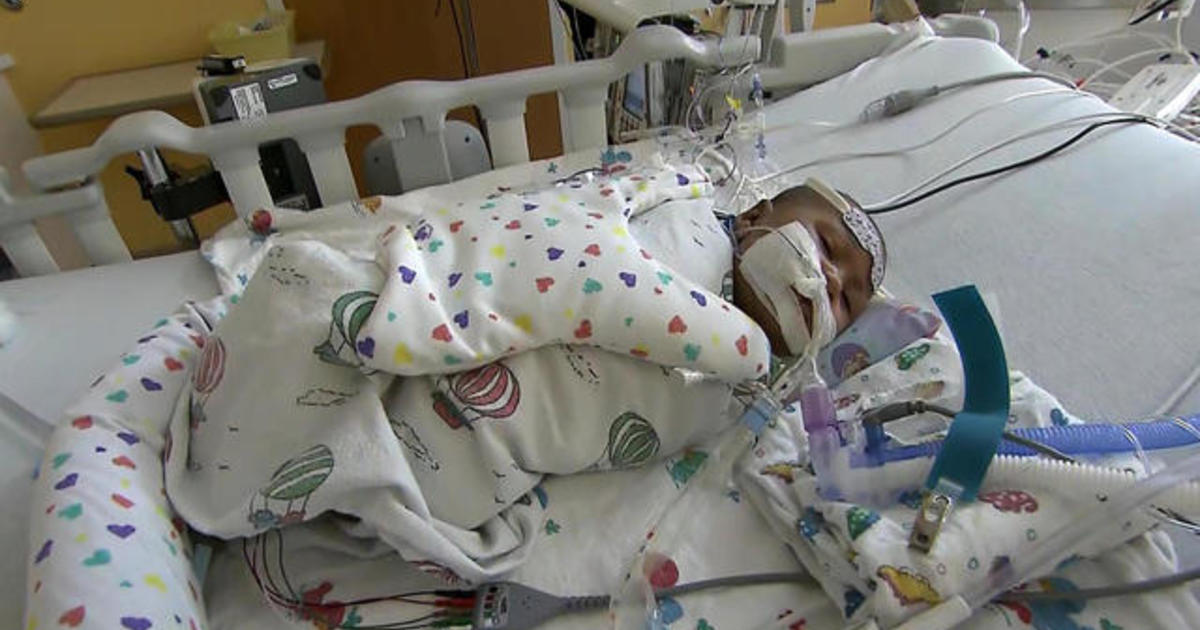 Hospitals See Rise In Babies With Respiratory Illness RSV - CBS News