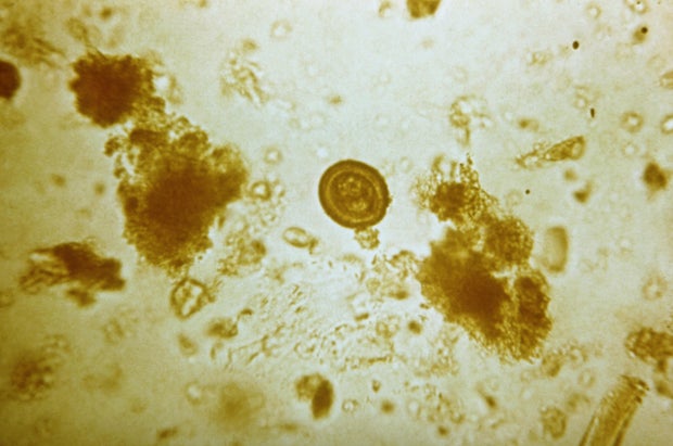 Как выглядит цепень у человека Как выглядит цепень у человека