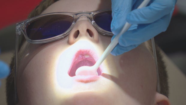 FREE DENTAL CHILDREN LR RAW 01 concatenated 155553_frame_8419 