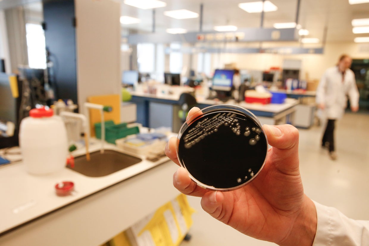 BELGIUM-HEALTH-LEGIONELLA-BACTERIA-RESEARCH 