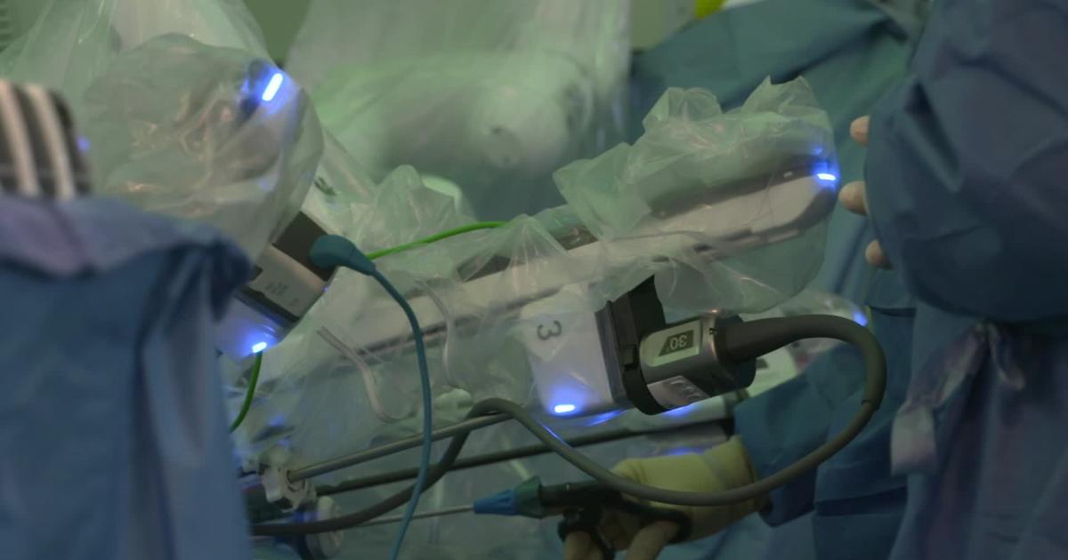 Cutting-edge Robot Making Open-heart Surgery Less Invasive - Cbs Miami