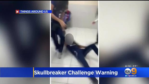 skullbreaker challenge 2 