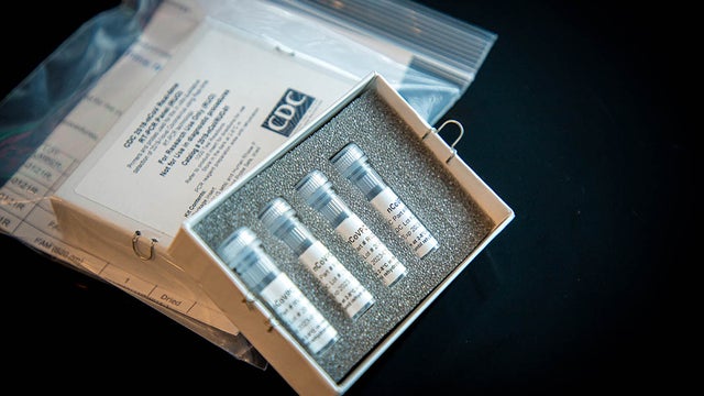 coronavirus-testkit-sample-5.jpg 