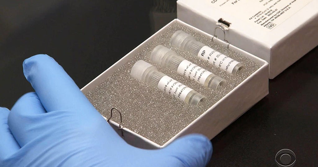 15 New Positive Coronavirus Tests In Massachusetts, Bringing State ...