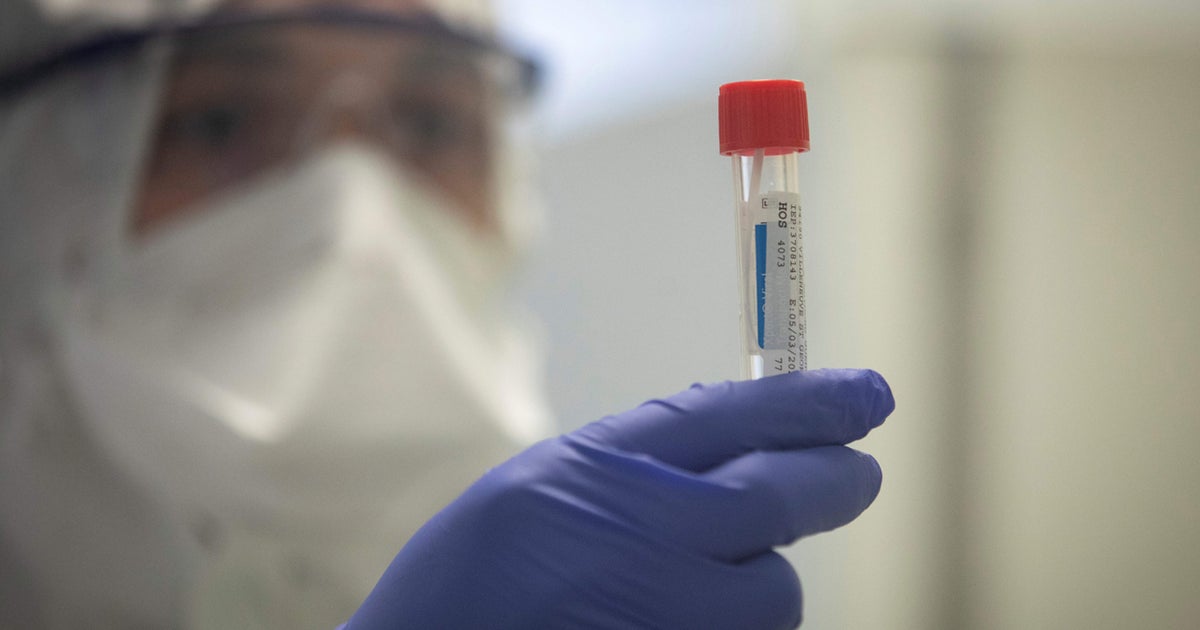 2 Coronavirus Cases Confirmed In Yuba County Good Day Sacramento