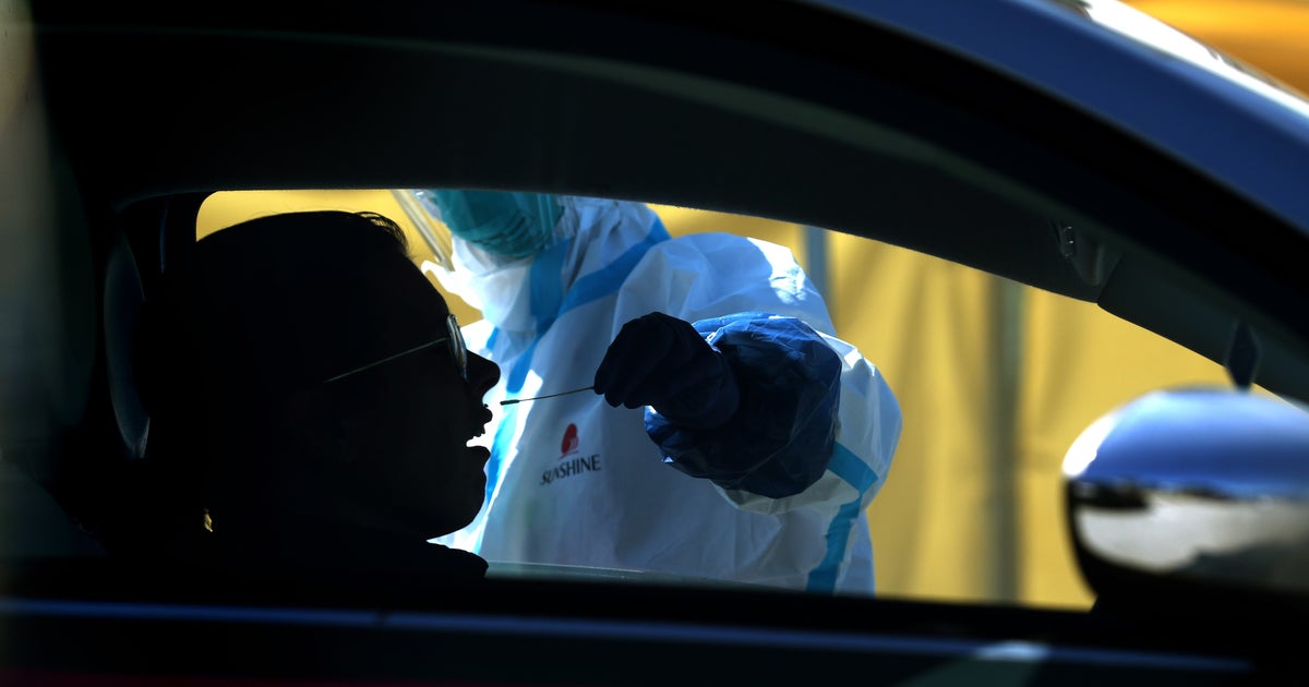 Coronavirus Pandemic 5 New Bay Area Deaths; Alameda Tops 800 Confirmed