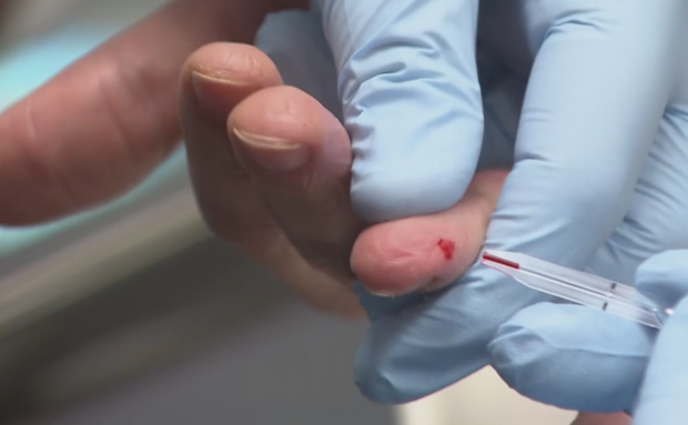 Finger prick blood test 