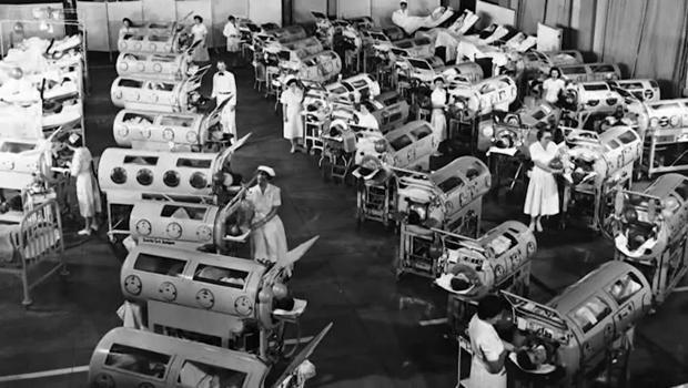 polio-iron-lungs-620.jpg 