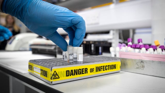 Infection-generic.jpg 