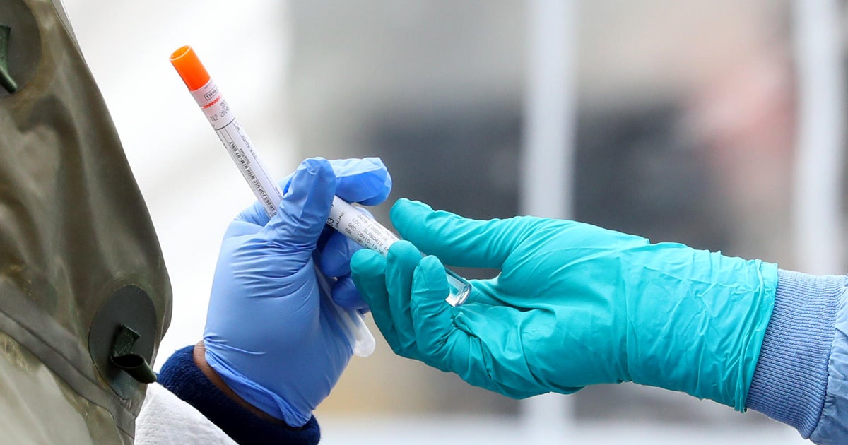 How long can coronavirus infections last in your body? CBS News