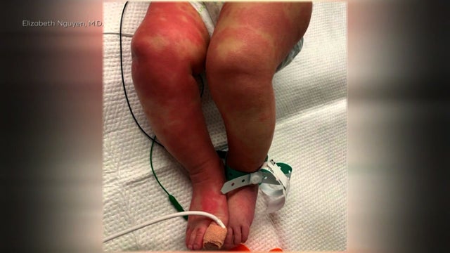 multi-system-inflammatory-syndrome-in-children-Elizabeth-Nguyen-M.D..jpg 