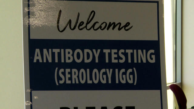 Serology-Antibody-Testing.jpg 