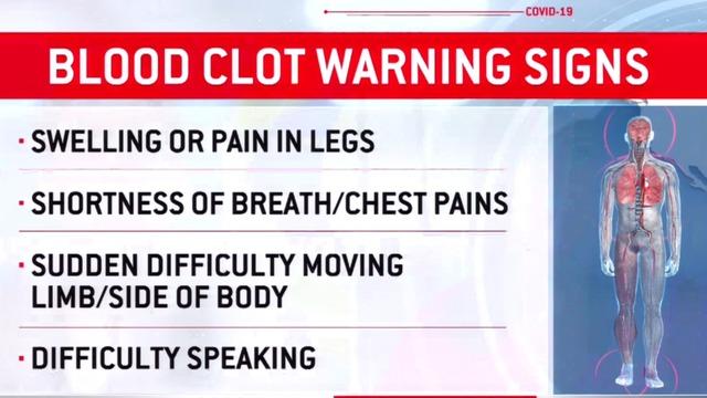cbsn-fusion-doctors-warn-of-potentially-deadly-blood-clots-in-covid-19-patients-thumbnail-490510-640x360.jpg 