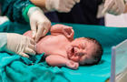 doctor cutting baby's umbilical cord 