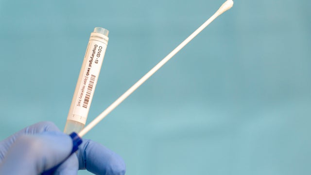 Cotton swab and test tube for Coronavirus test (COVID-19)), macro image of medical equipment in hands of healthcare professional 