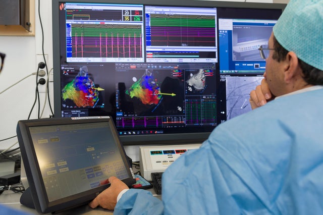 Radiofrequency Ablation 