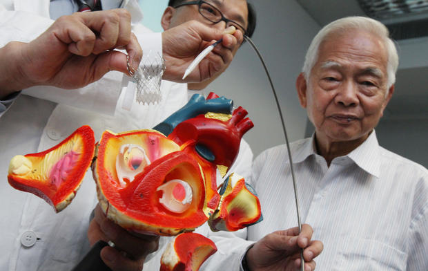 Transcatheter aortic valve replacement cost 